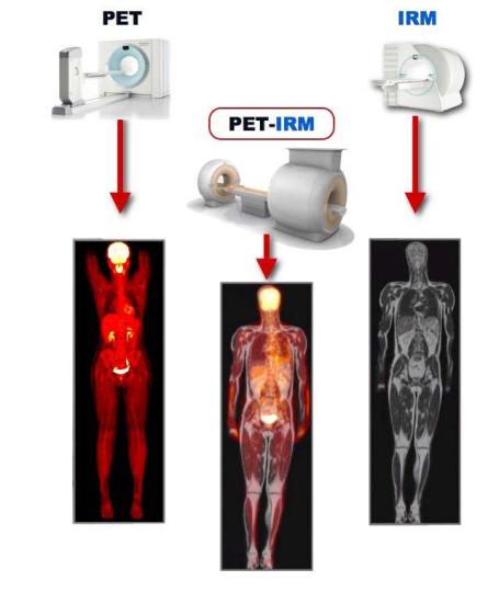 PET-MRI scanner combines the imaging of both modalities in one unit