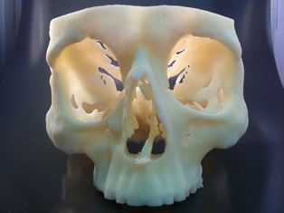3D print of part of a skull