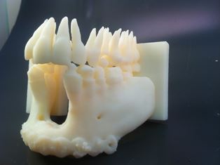 3D print of a jaw