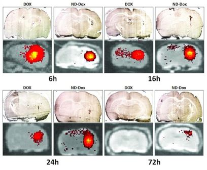 Images showing the retention of doxorubicin and ND-DOX in brain tissue