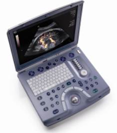 The Voluson e ultrasound system