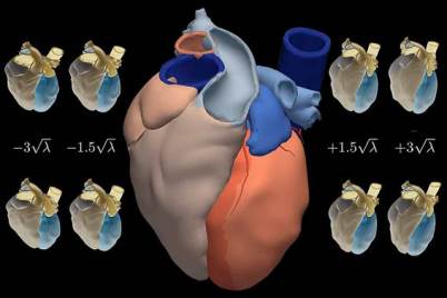 Atlas of the human heart