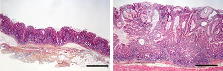 Microscope view of cells from the anterior (left - with Botox) and posterior (right) halves of the stomach of mice with cancer.