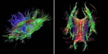 Images of the nerve structure of the brain