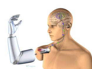 Drawing showing how the brain can control the prosthetic arm
