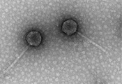 Electron microscopy image of the bacteriophages.