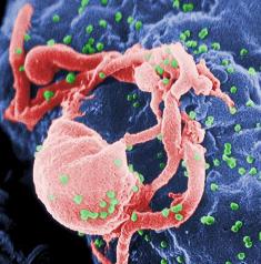 Scanning electron micrograph of HIV (green spheres) budding from cultured lymphocyte. Photo credit: C Goldsmith, US CDC