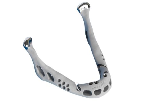 The titanium jaw manufactured by additive manufacturing