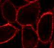 A fluorescent drug (in red) binding to an adenosine receptor on the surface of living cells