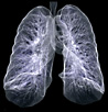 A healthy lung