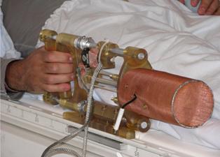 A volunteer squeezing the handles of the Magnetic Resonance Compatible Hand-Induced Robotic Device (MR_CHIROD) while lying in the magnet of the machine.