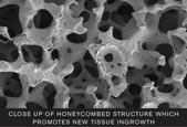 Close-up of the honeycomb structure that promotes new tissue growth