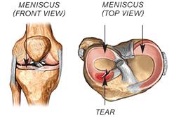 Diagram of the knee