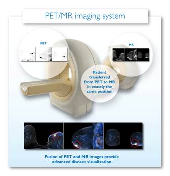 Showing combined imaging of Philips PET-MRI system