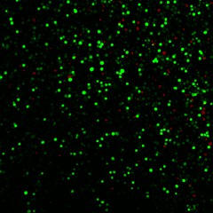 human prostate cancer cells is shown after exposure to laser-activated carbon nanoparticles