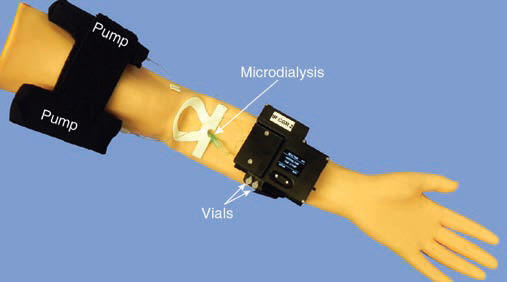 The arm-worn IR glucose sensor