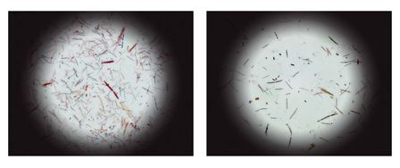 Colonies of bacteria from mice with rich (left panel) or poor (right panel) bacterial communities.