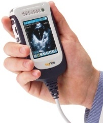 The Signostics ultrasound scanner