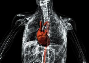 An artist's impression of the smart aortic pump implanted in the aorta