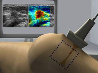 The new ultrasound scanner designed by Plexus for SuperSonic Imagine has the potential to speed up cancer diagnosis.