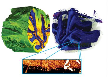 Profondeurs du cervelet: la matière blanche (orange) se distingue de deux types de matière grise (bleu: couche granuleuse; jaune: couche moléculaire). Même les vaisseaux sanguins (rouge) et les différentes cellules (image en bas) sont clairement visibles. Photo: Martin E Scwab/SNF